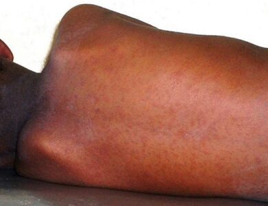 Image d'illustration